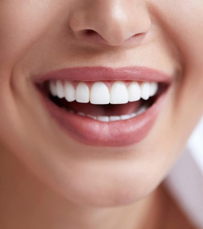 Healthy Teeth Matter - Surbiton Dental