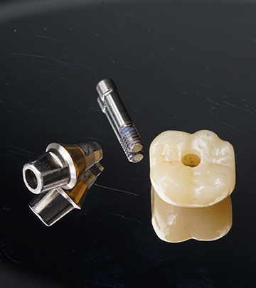 Screw retained crown