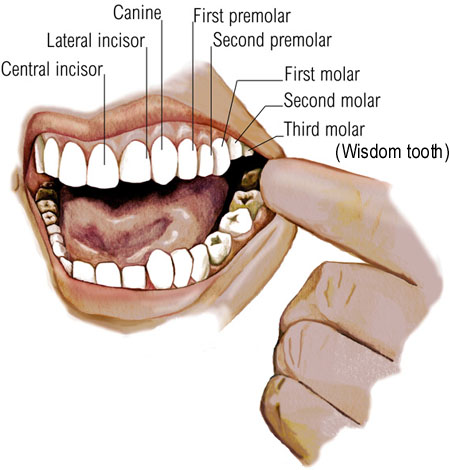 wisdom teeth before and after