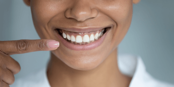 Healthy teeth and gums