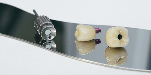 Screw retained crown