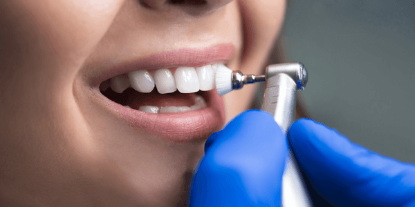 Teeth whitening process