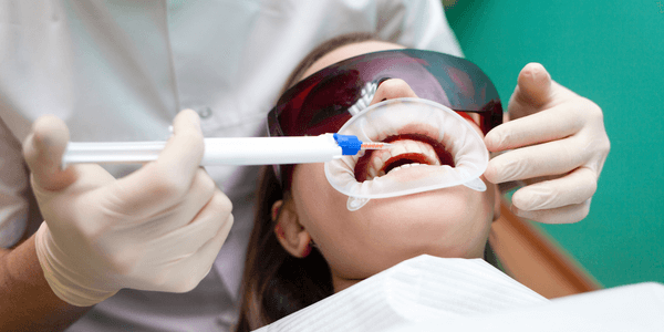Tooth whitening (2)
