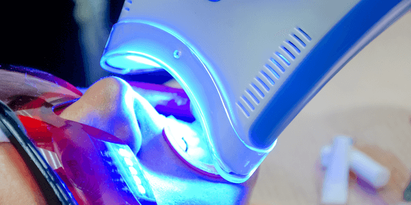 Tooth whitening