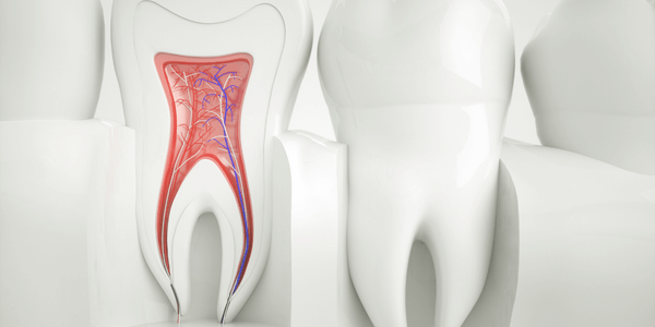 Root canal treatment