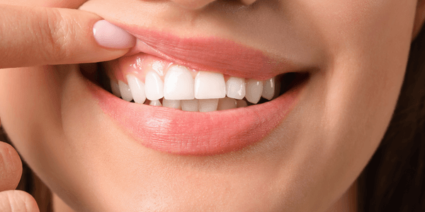 Healthy teeth and gums 