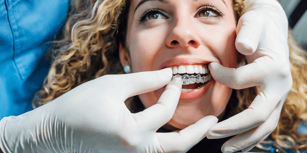 Invisalign treatment