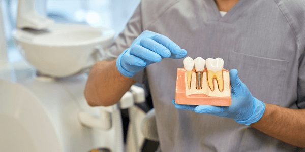 Dental impant_ Endosteal implants