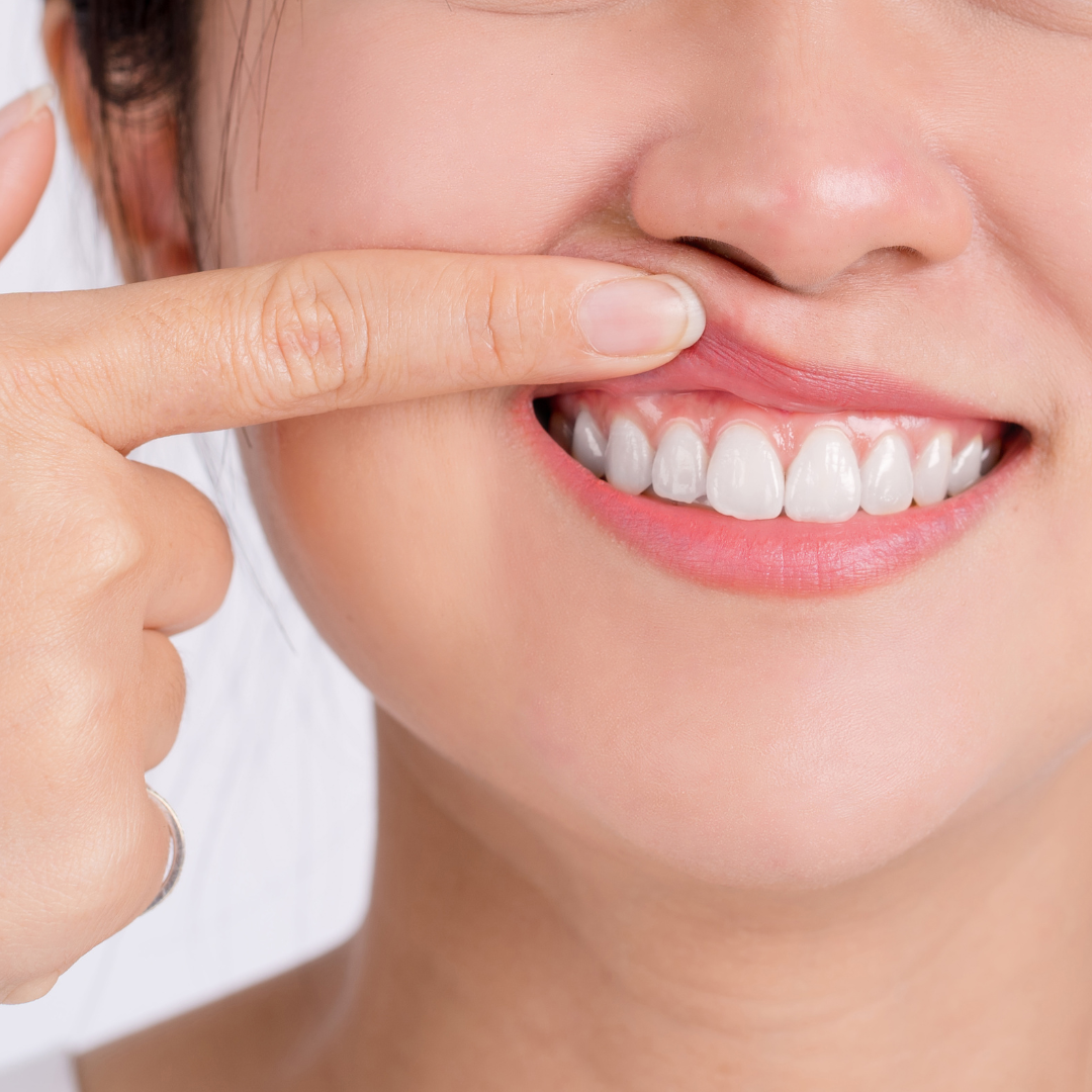 Periodontist