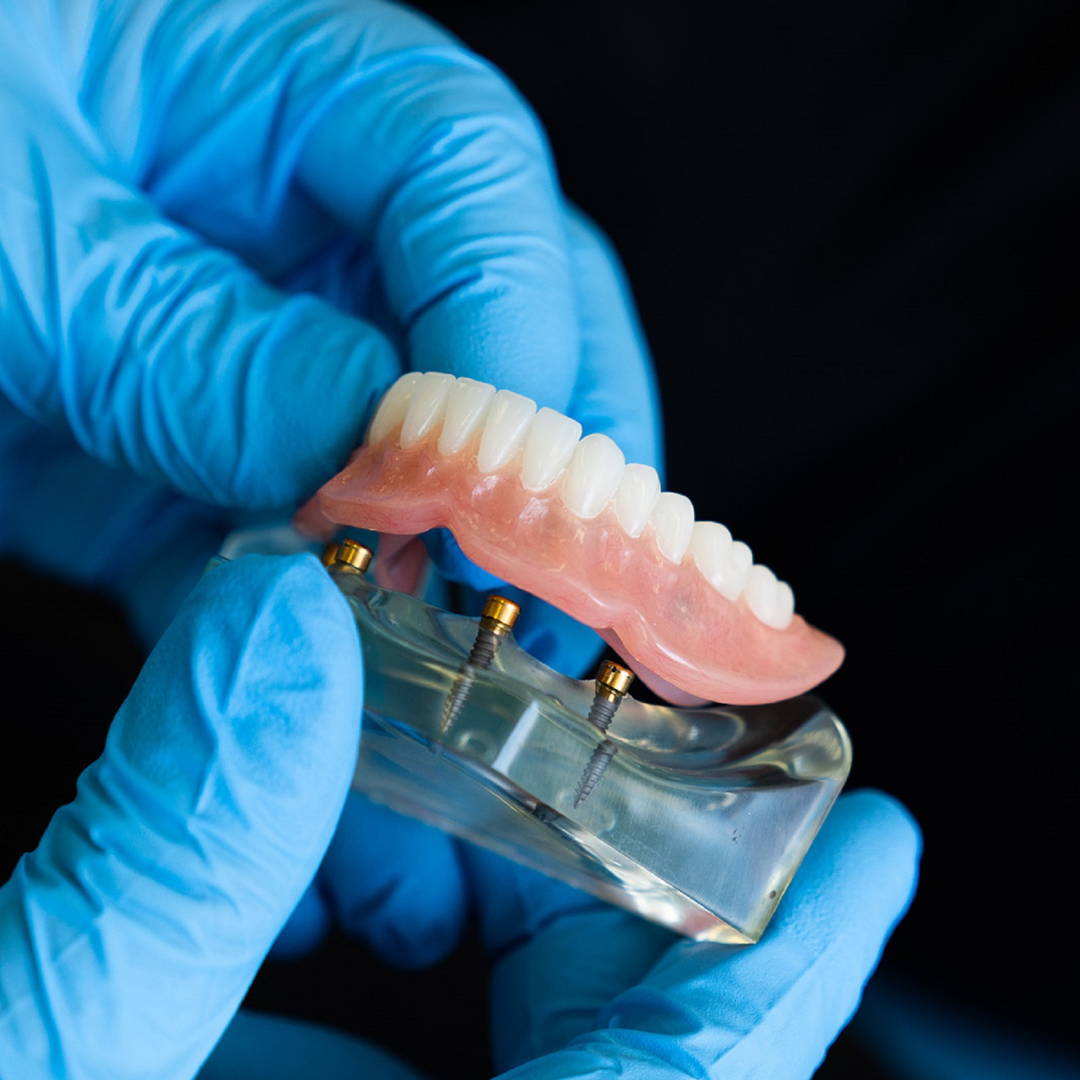 Dentures