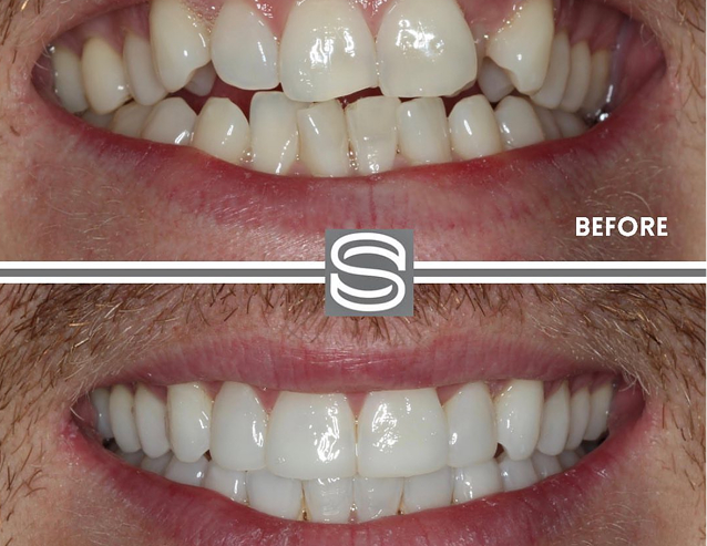 Dental Treatment at Surbiton Dental