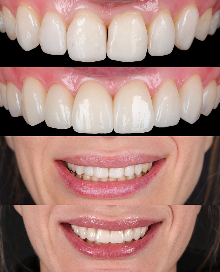 Patient receiving dental treatment