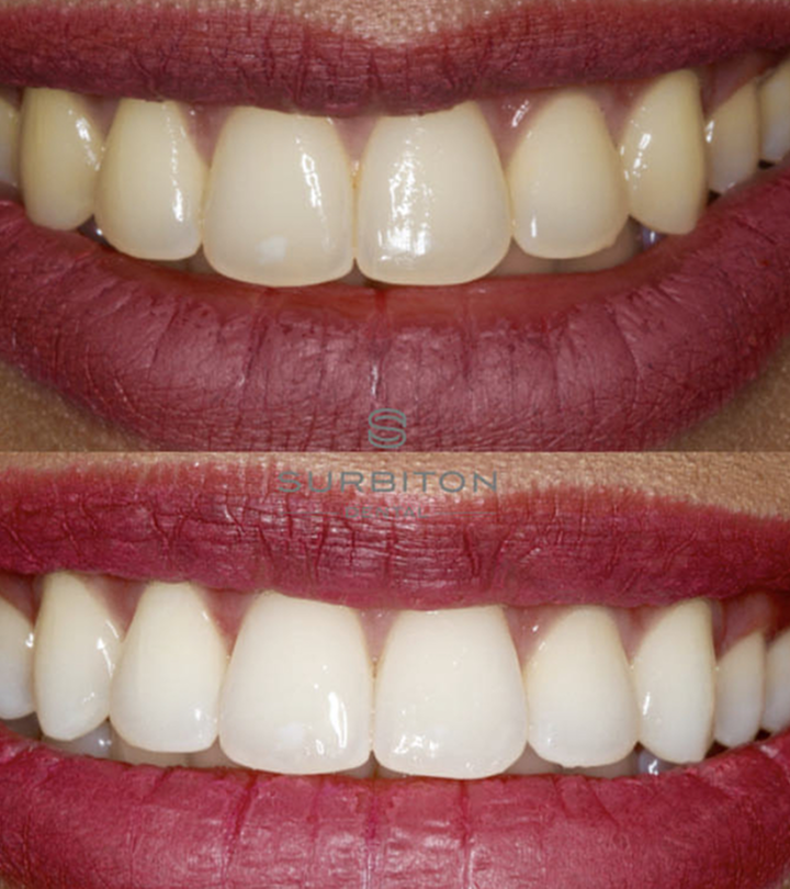 Patient receiving dental treatment