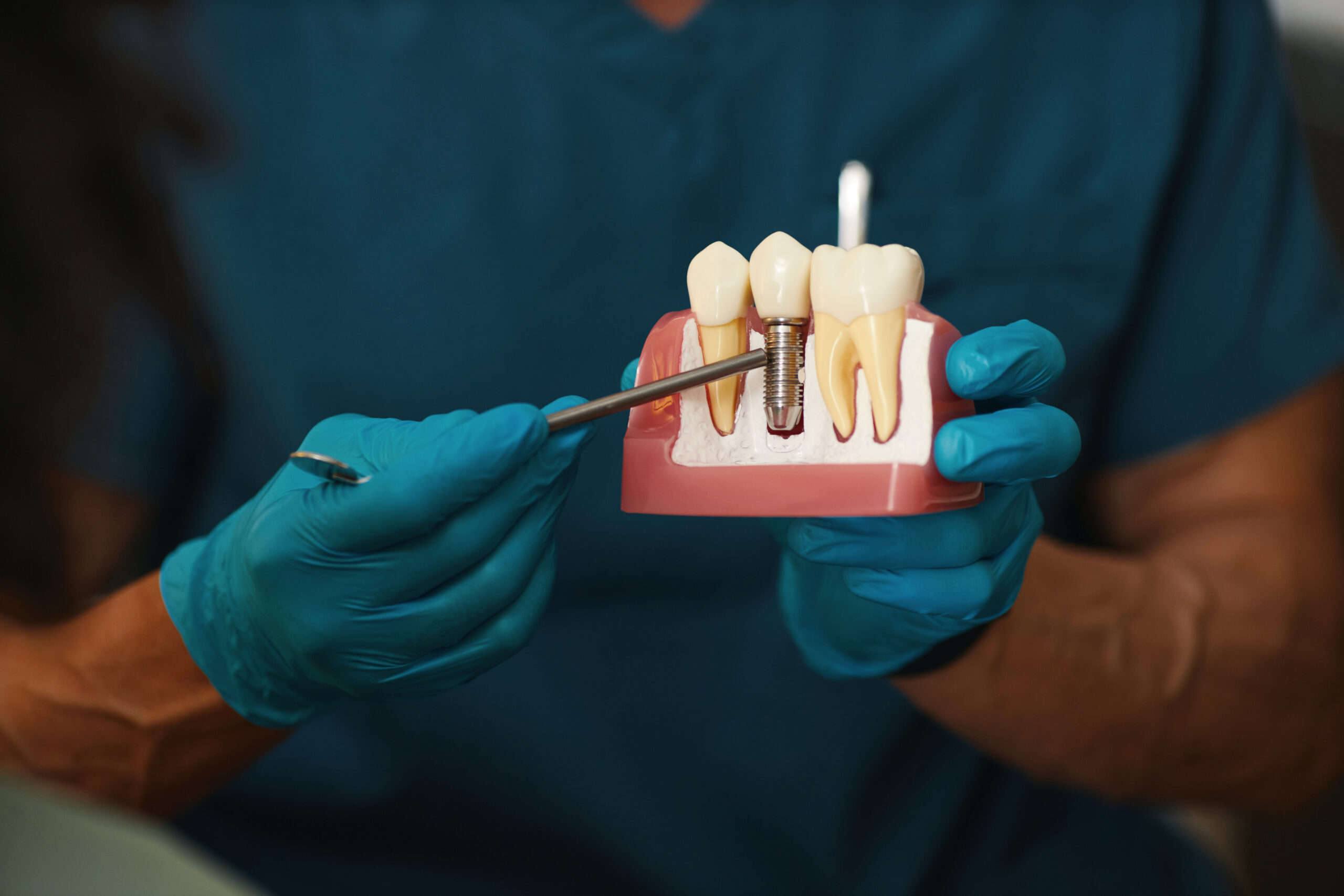 Dentist holding an anatomical jaw model demonstrating a titanium dental implant post and crown